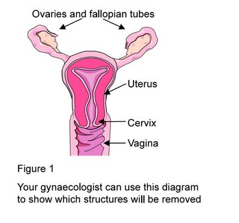 hysterectomy abdominal laparoscopic healthcare eido copyright limited